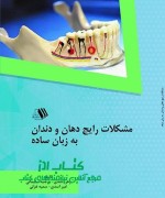 مشکلات رایج دهان و دندان به زبان سا